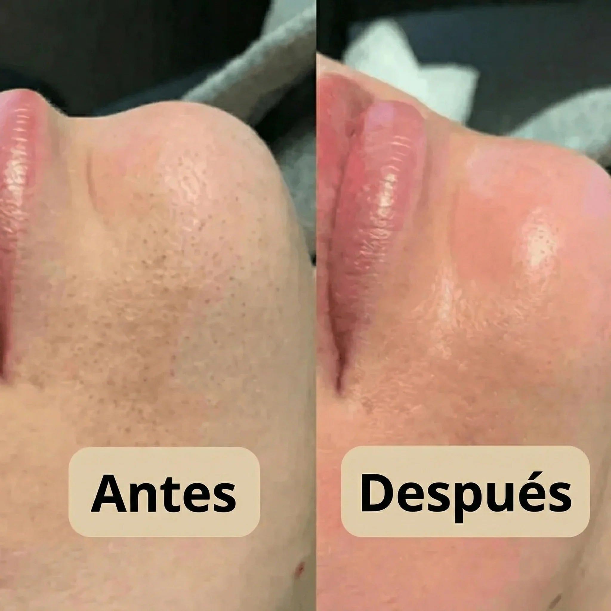 Peeling Shot Coreano