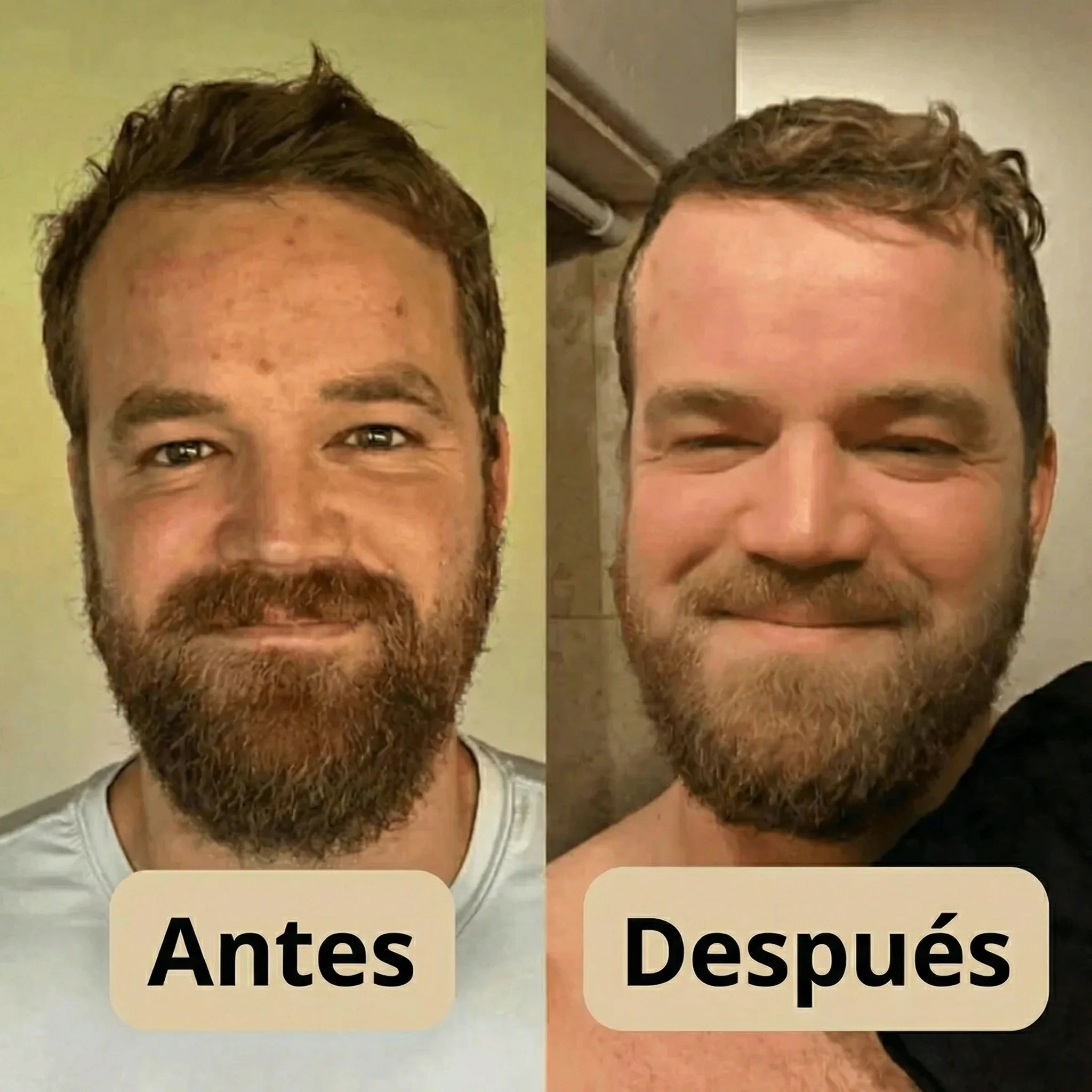 Peeling Shot Coreano