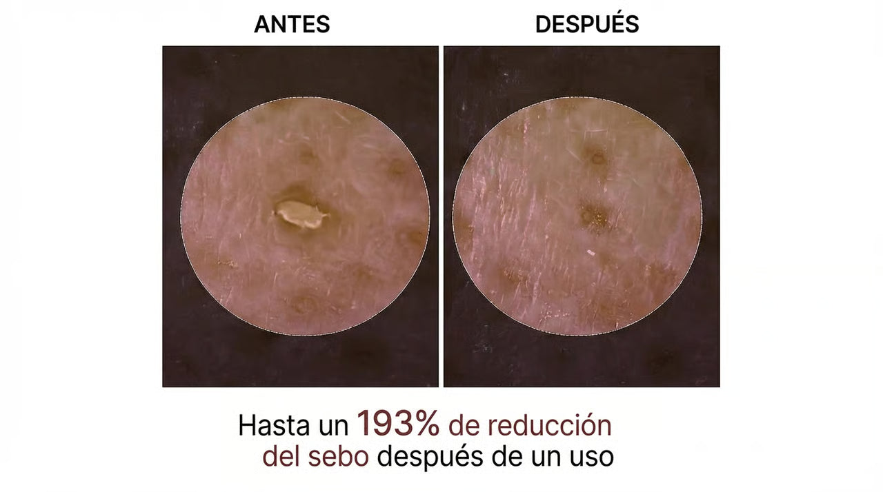 Peeling Shot Coreano